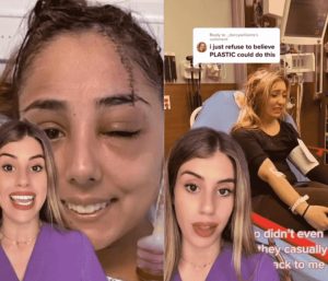 pinza pelo accidente coche.jpg