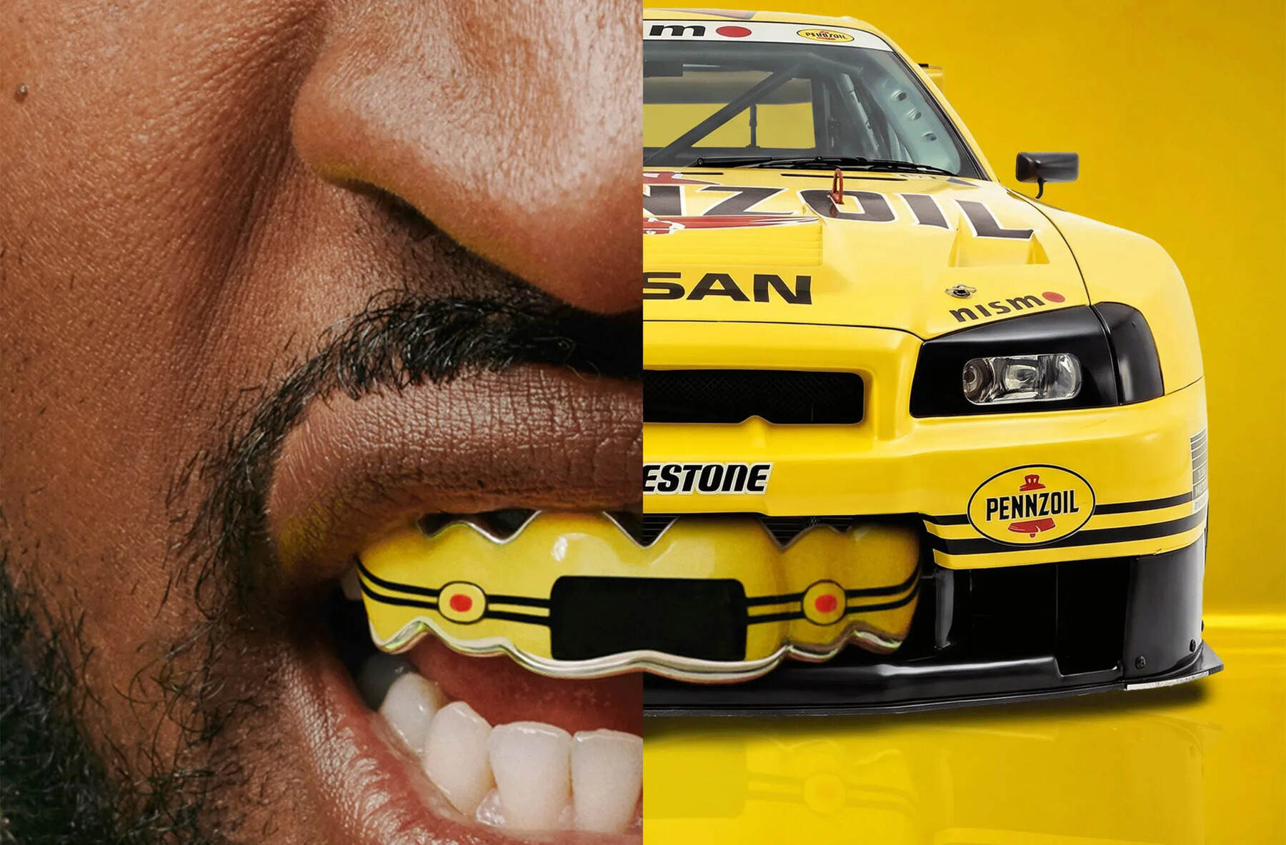 Nissan dientes